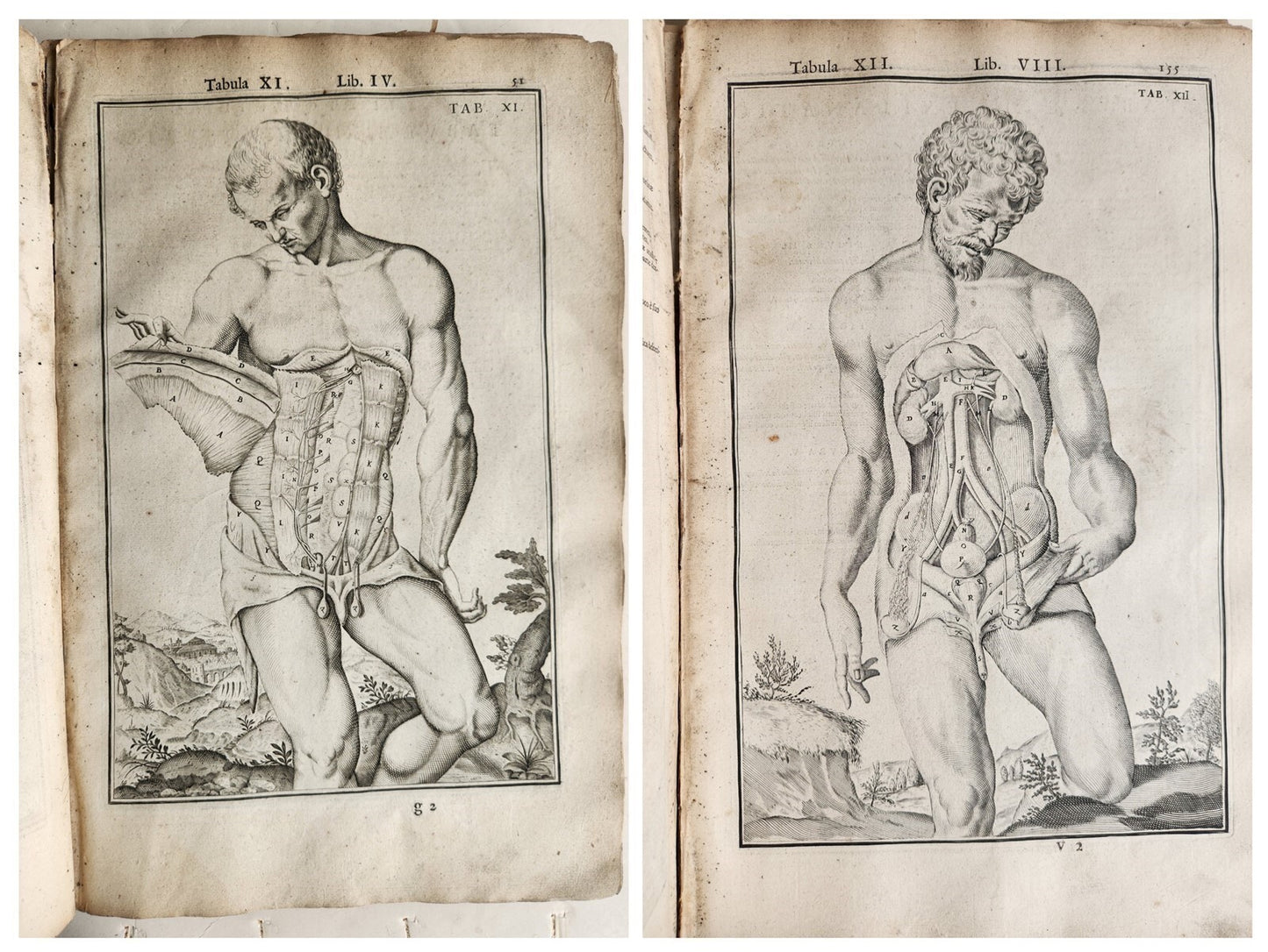 1645 ANATOMY TREATISE Adrian Spigelius 176 ENGRAVINGS ILLUSTRATED FOLIO antique