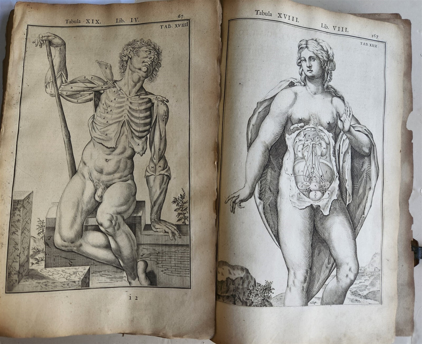 1645 ANATOMY TREATISE Adrian Spigelius 176 ENGRAVINGS ILLUSTRATED FOLIO antique
