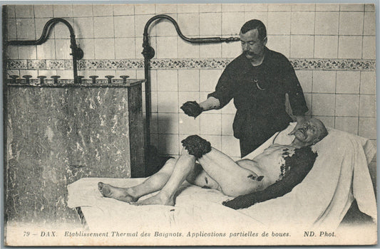 MUD BATHS SPA PROCEDURE ANTIQUE POSTCARD
