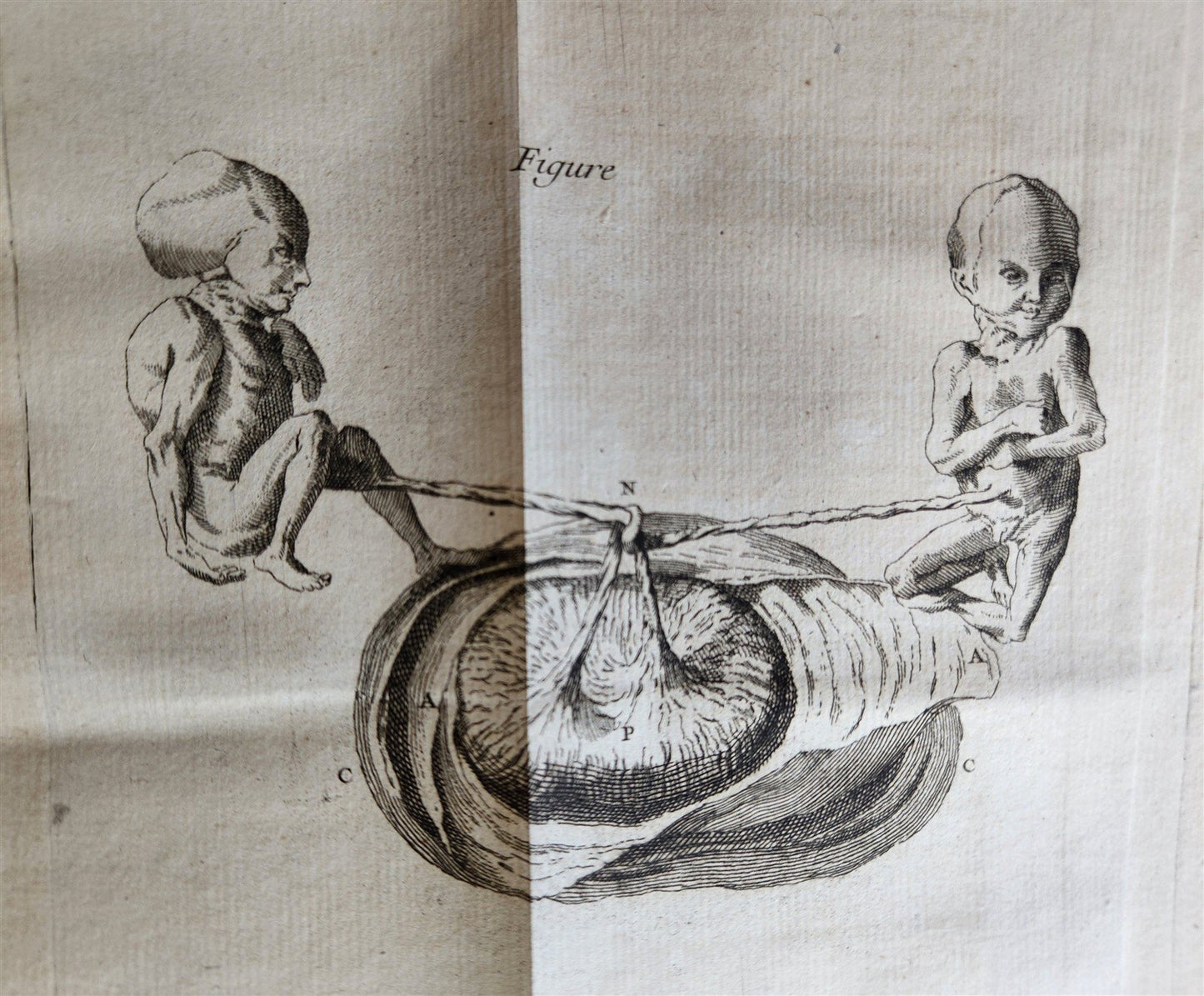 1761 MEDICAL TREATISE ILLUSTRATED ANATOMY by Francois PLANQUE antique V.6