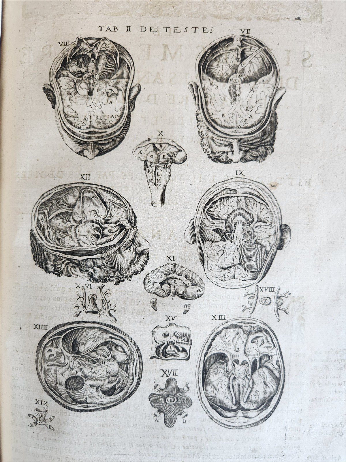 1646 ANATOMY ILLUSTRATED FOLIO antique MEDICAL Oeuvres de Me André dv Lavrens