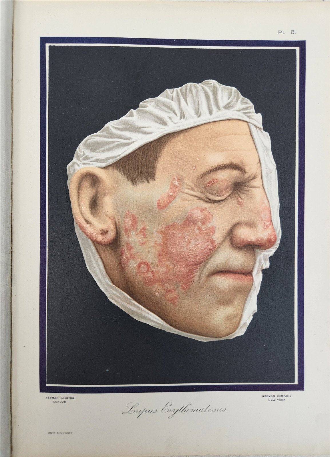 1895 PICTORIAL ATLAS of SKIN DISEASES & SYPHILITIC AFFECTION antique ILLUSTRATED