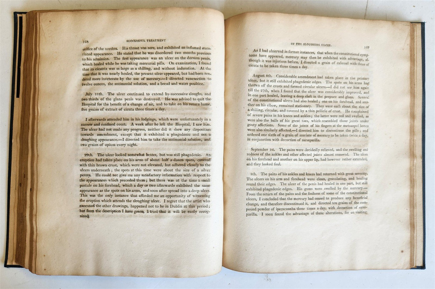 1814 ILLUSTRATED ESSAY on VENEREAL DISEASES confounded with Syphilis antique