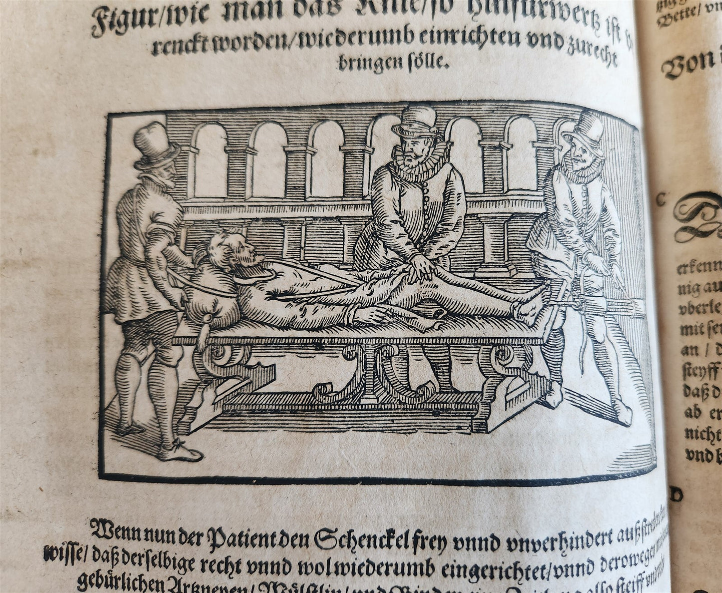 1601 WOUND MEDICINE antique ILLUSTRATED WundArtzney oder Artzney spiegell FOLIO