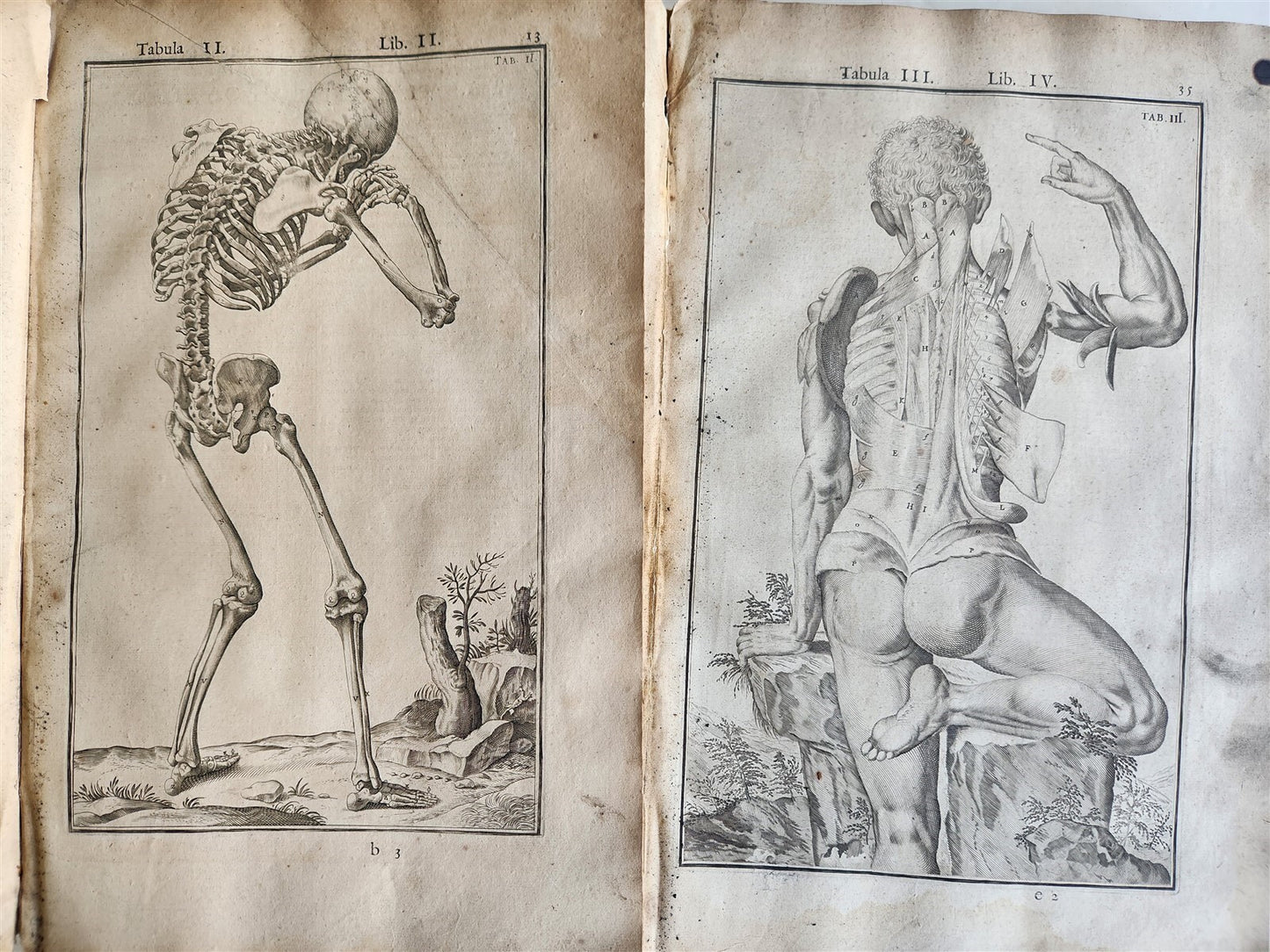 1645 ANATOMY TREATISE Adrian Spigelius 176 ENGRAVINGS ILLUSTRATED FOLIO antique