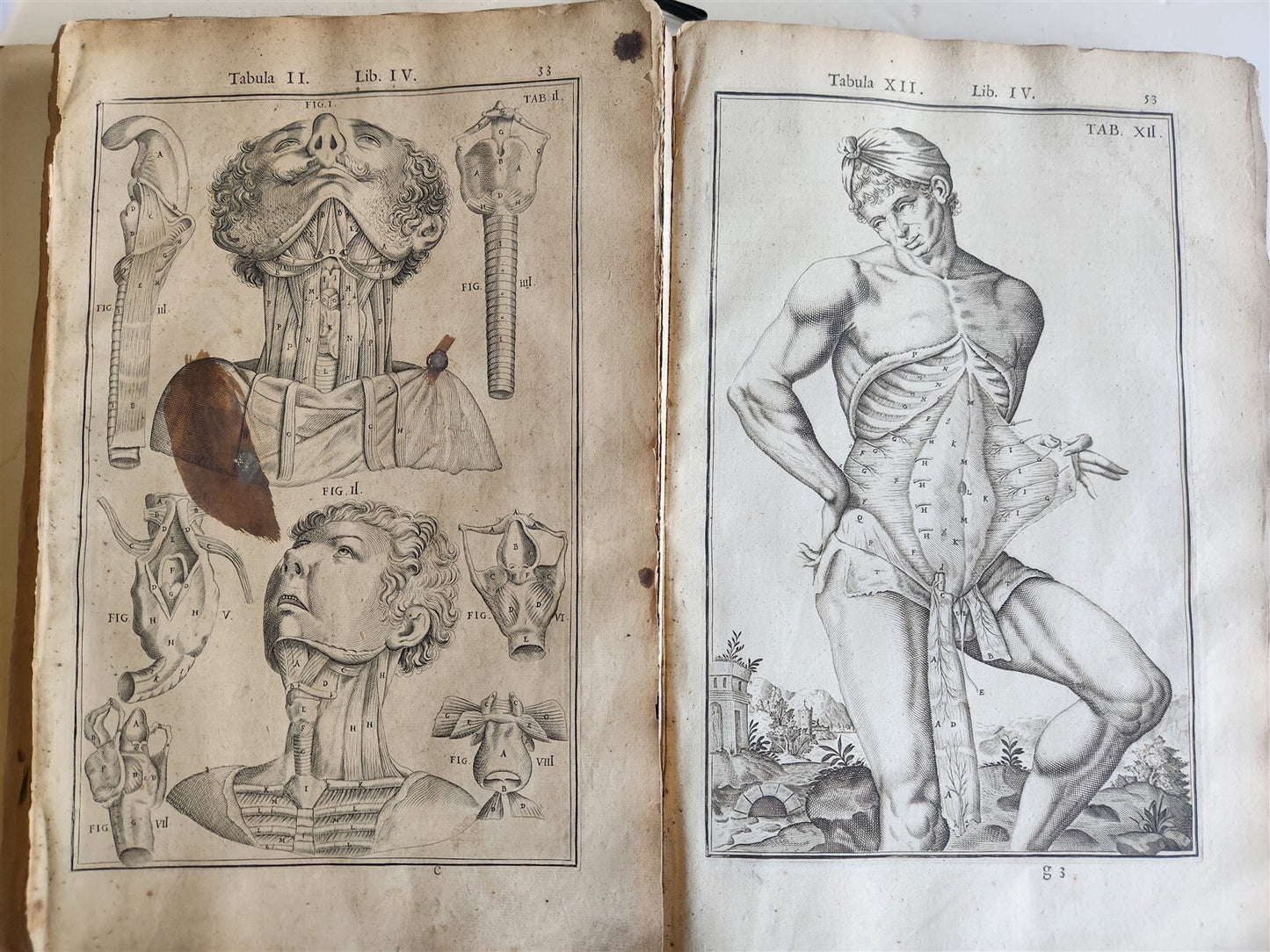 1645 ANATOMY TREATISE Adrian Spigelius 176 ENGRAVINGS ILLUSTRATED FOLIO antique