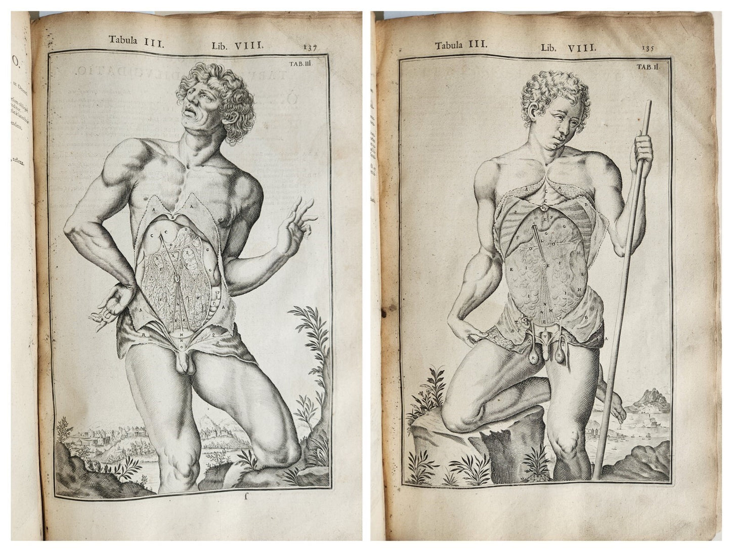 1645 ANATOMY TREATISE Adrian Spigelius 176 ENGRAVINGS ILLUSTRATED FOLIO antique