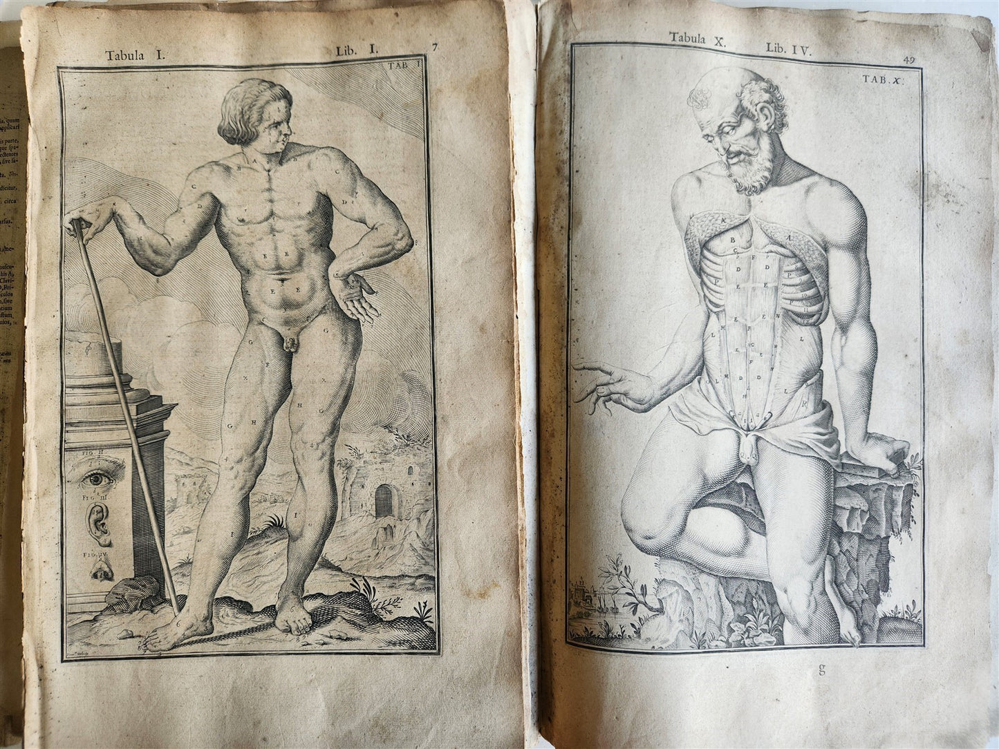 1645 ANATOMY TREATISE Adrian Spigelius 176 ENGRAVINGS ILLUSTRATED FOLIO antique