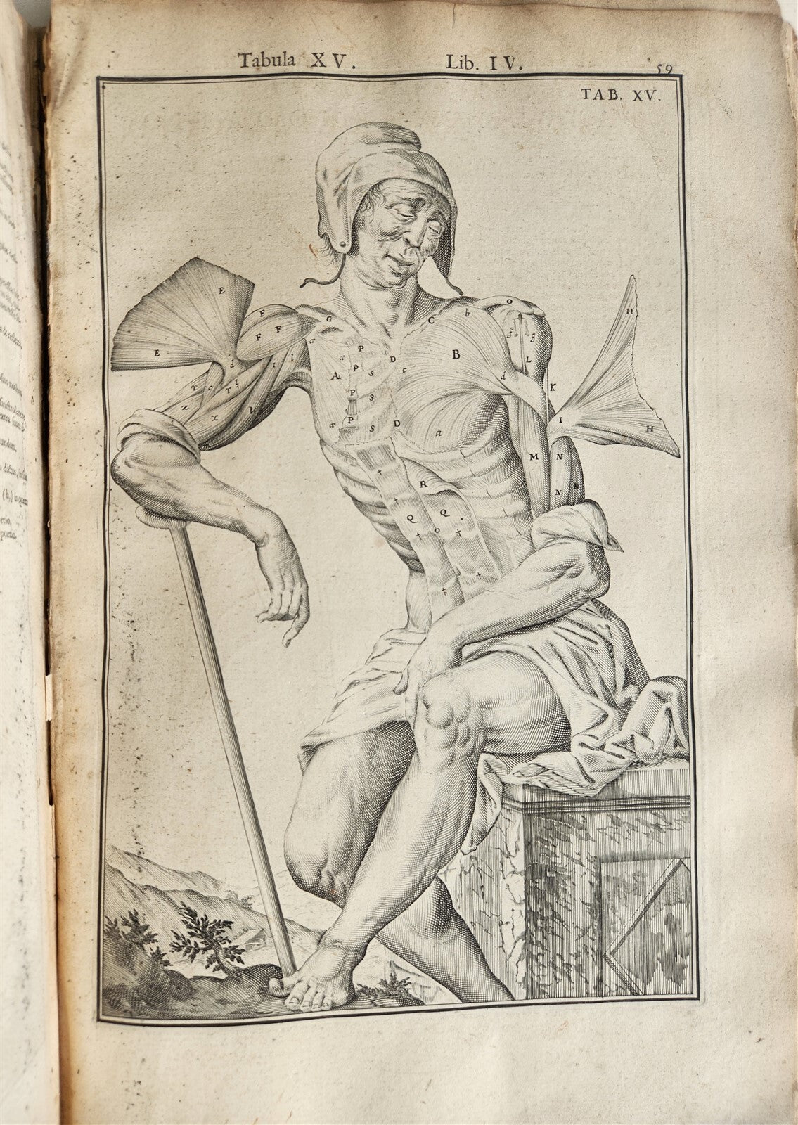 1645 ANATOMY TREATISE Adrian Spigelius 176 ENGRAVINGS ILLUSTRATED FOLIO antique