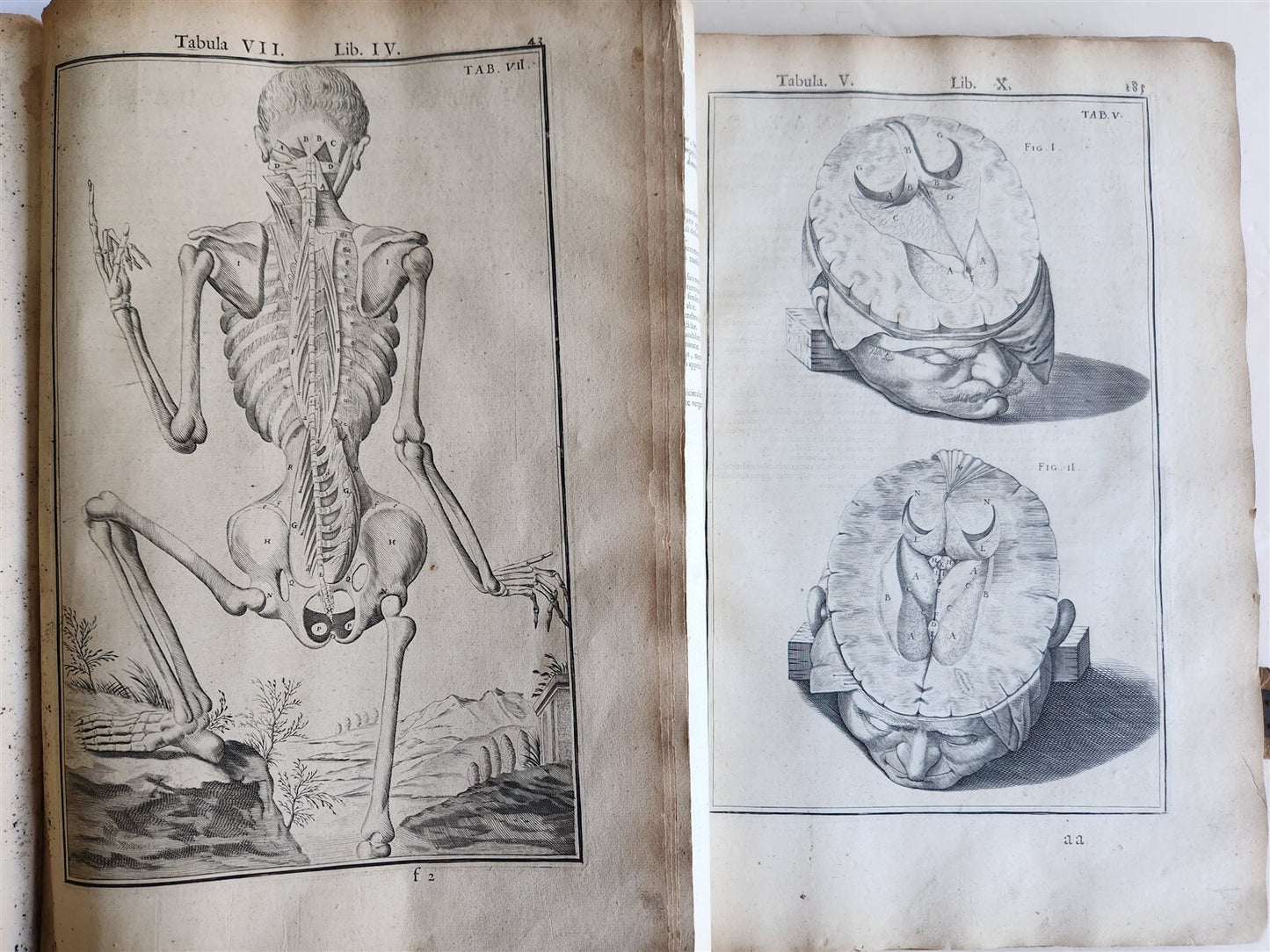1645 ANATOMY TREATISE Adrian Spigelius 176 ENGRAVINGS ILLUSTRATED FOLIO antique
