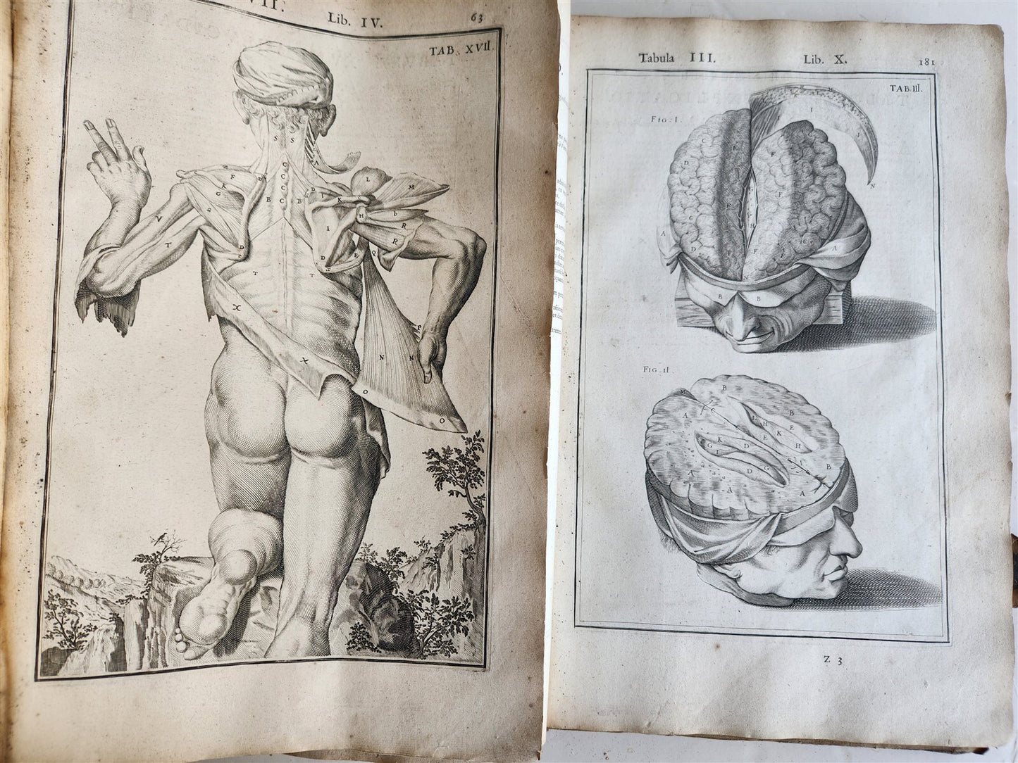 1645 ANATOMY TREATISE Adrian Spigelius 176 ENGRAVINGS ILLUSTRATED FOLIO antique