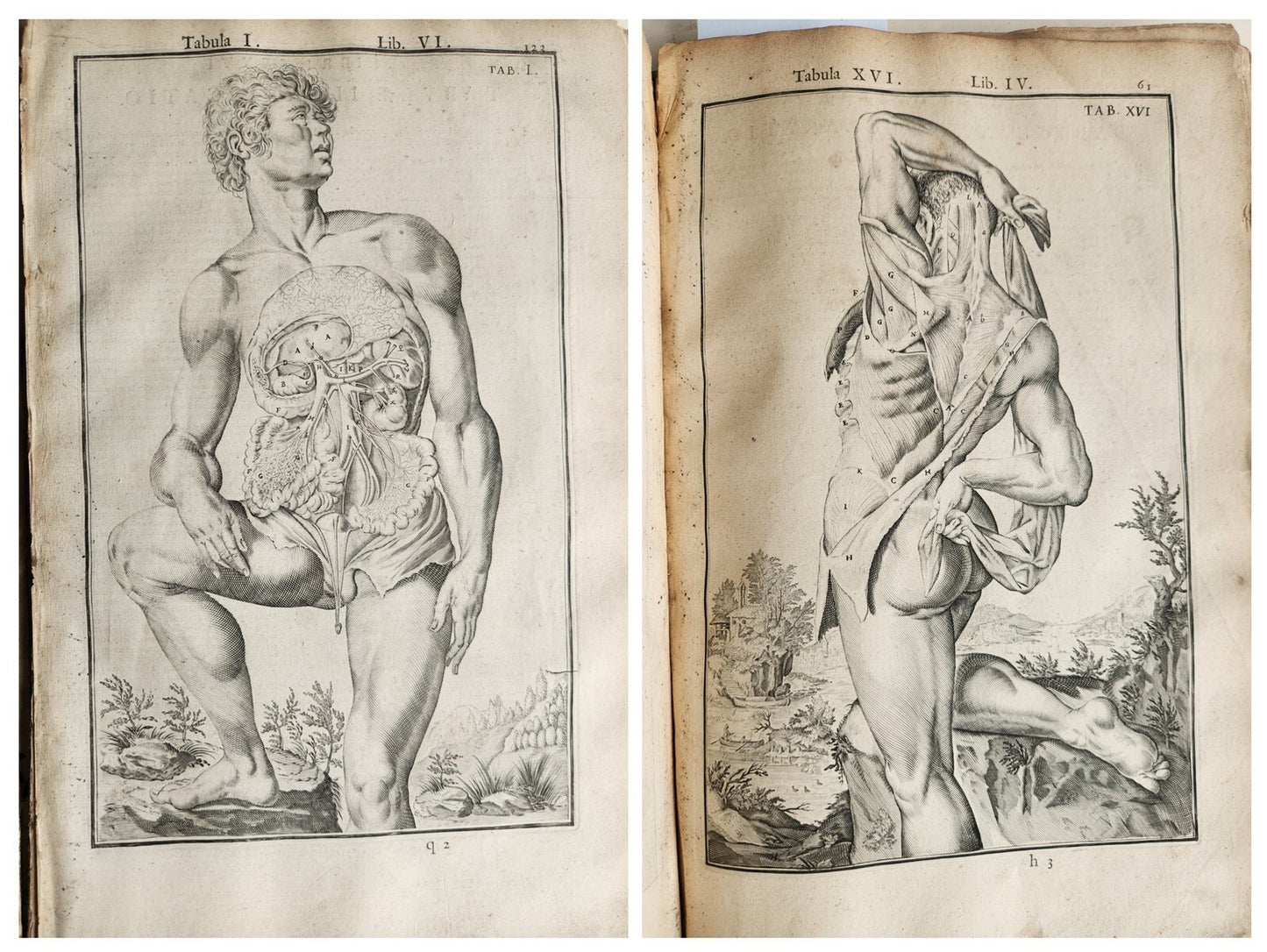 1645 ANATOMY TREATISE Adrian Spigelius 176 ENGRAVINGS ILLUSTRATED FOLIO antique