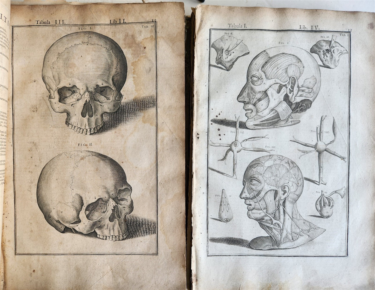 1645 ANATOMY TREATISE Adrian Spigelius 176 ENGRAVINGS ILLUSTRATED FOLIO antique