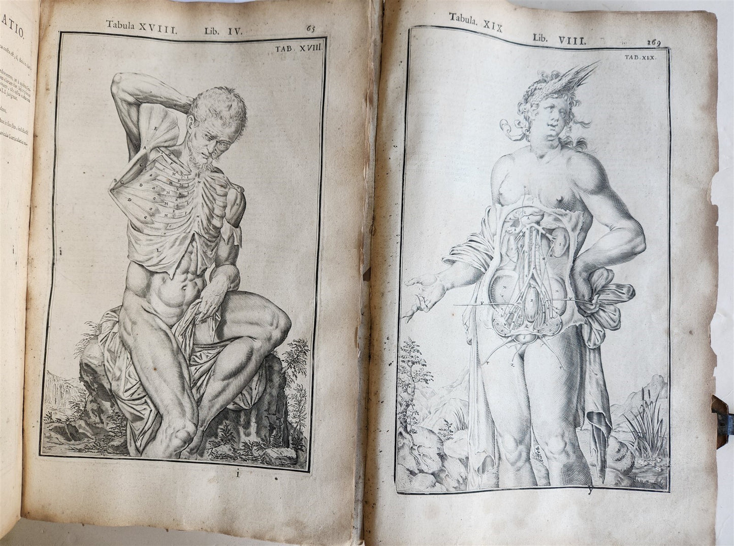 1645 ANATOMY TREATISE Adrian Spigelius 176 ENGRAVINGS ILLUSTRATED FOLIO antique