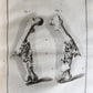 1753 SURGERY ANATOMY ILLUSTRATED antique Memoires l'Academie Royale de Chirurgie