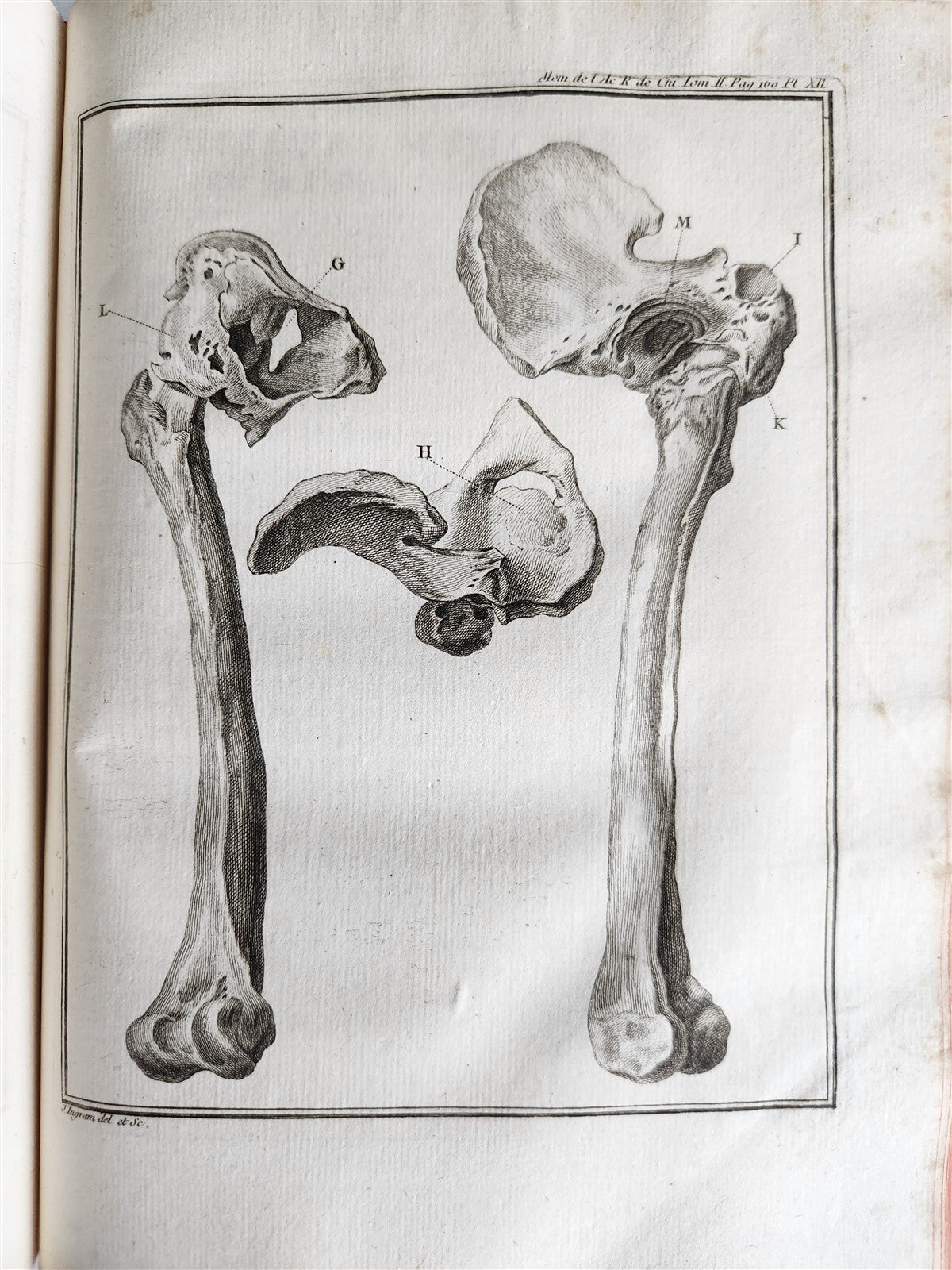 1757 SURGERY ANATOMY ILLUSTRATED antique Memoires l'Academie Royale de Chirurgie