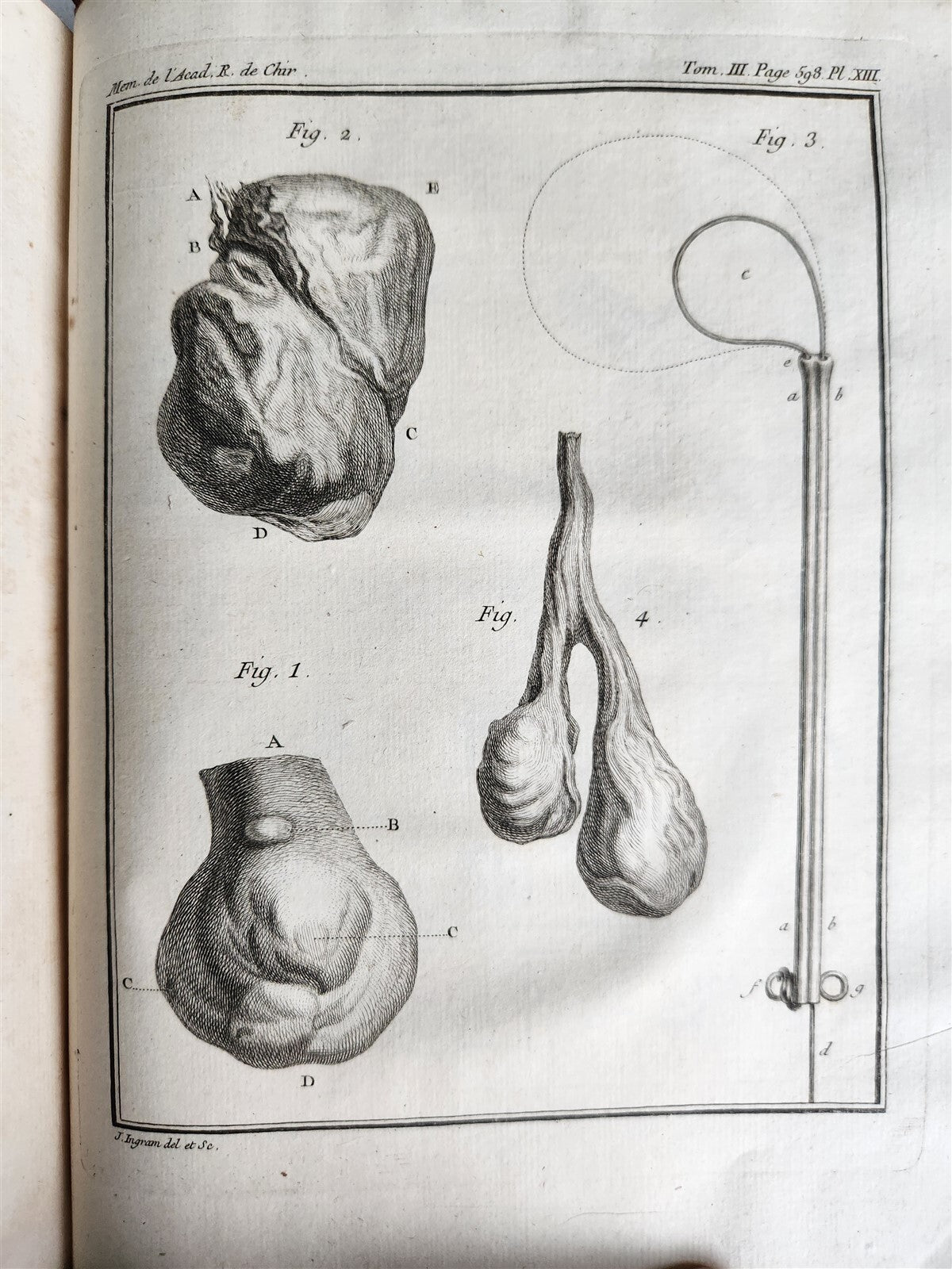 1753 SURGERY ANATOMY ILLUSTRATED antique Memoires l'Academie Royale de Chirurgie