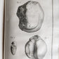 1753 SURGERY ANATOMY ILLUSTRATED antique Memoires l'Academie Royale de Chirurgie
