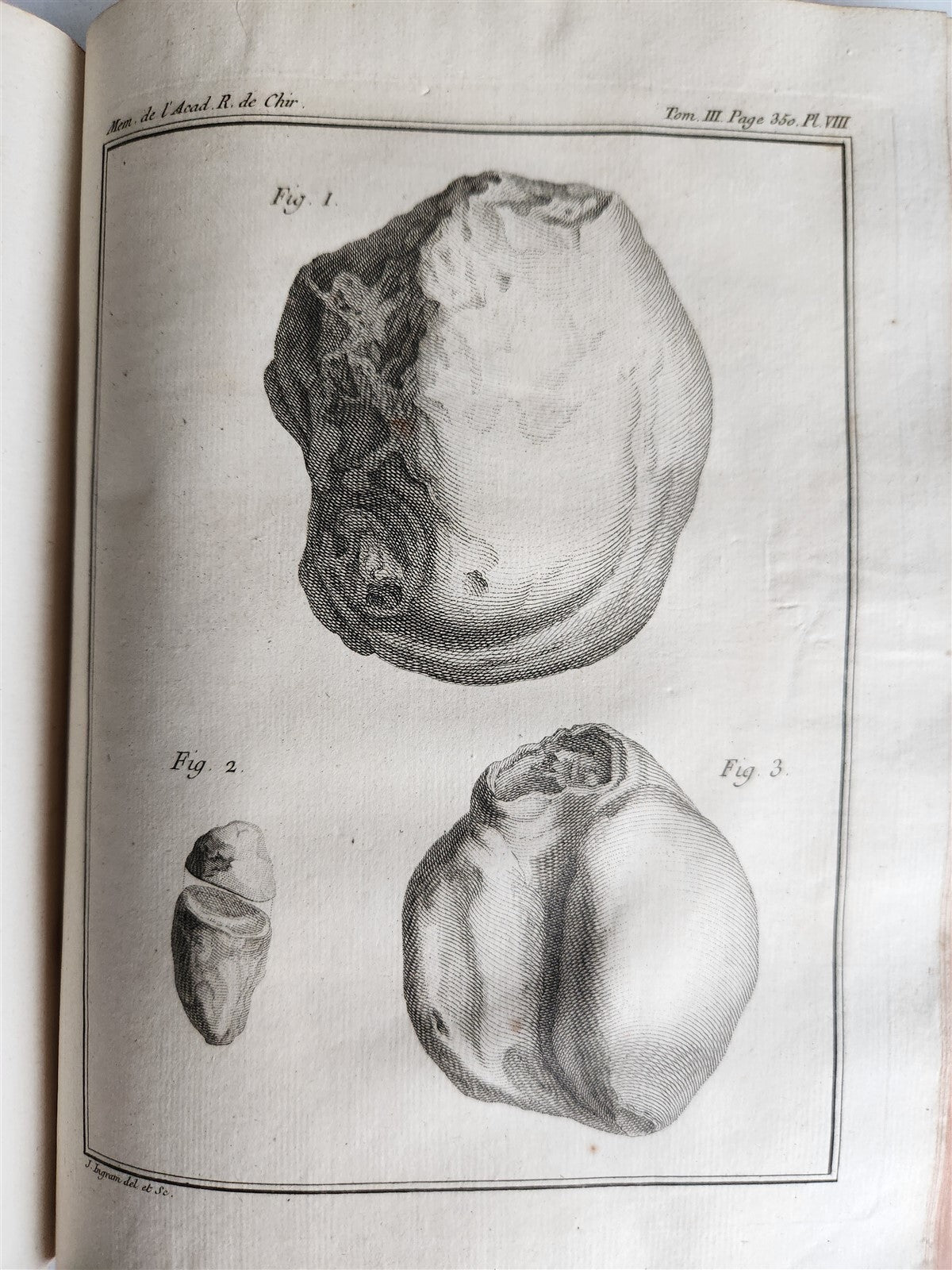 1753 SURGERY ANATOMY ILLUSTRATED antique Memoires l'Academie Royale de Chirurgie