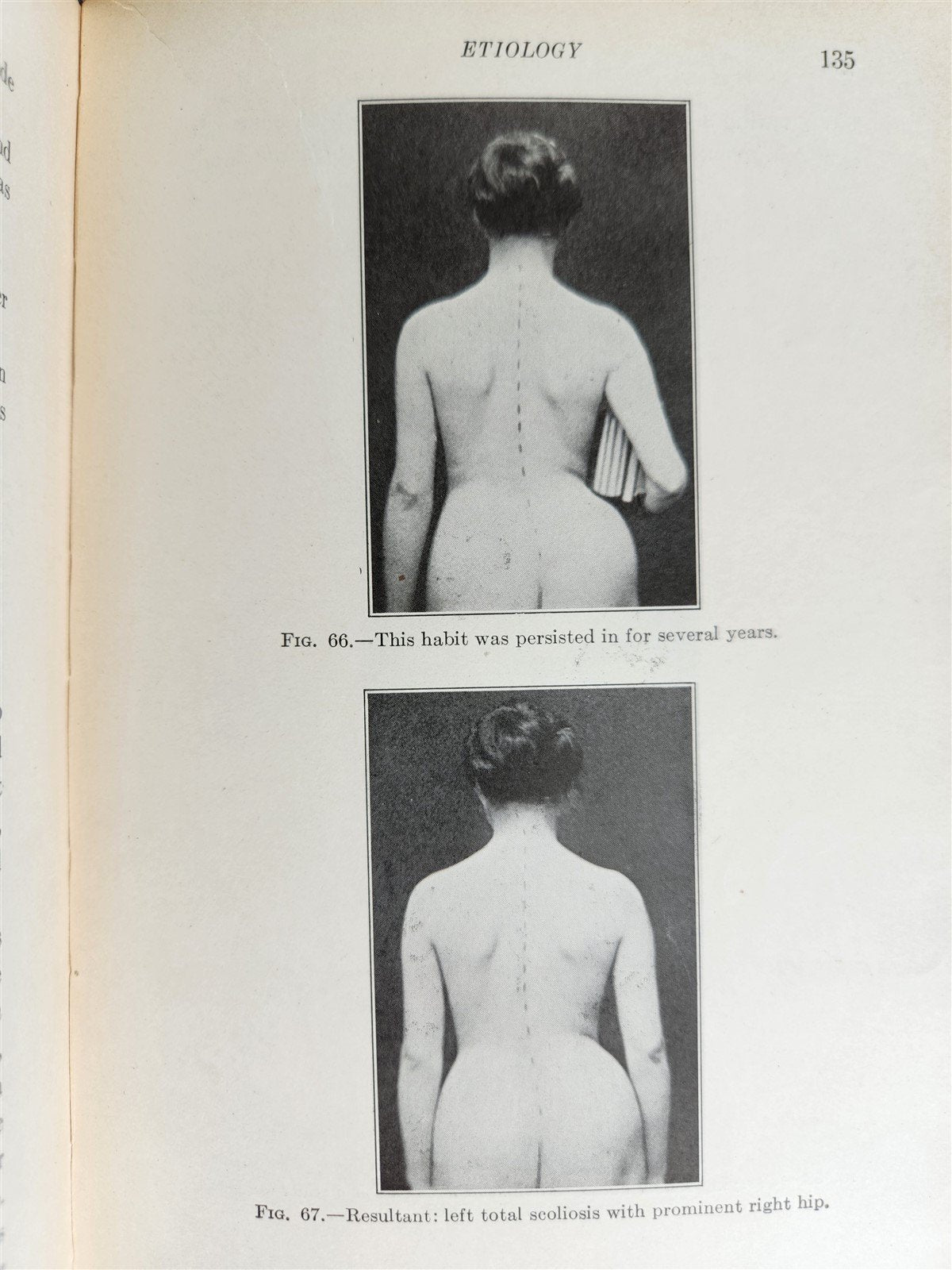 1922 INDIVIDUAL GYMNASTICS antique ILLUSTRATED