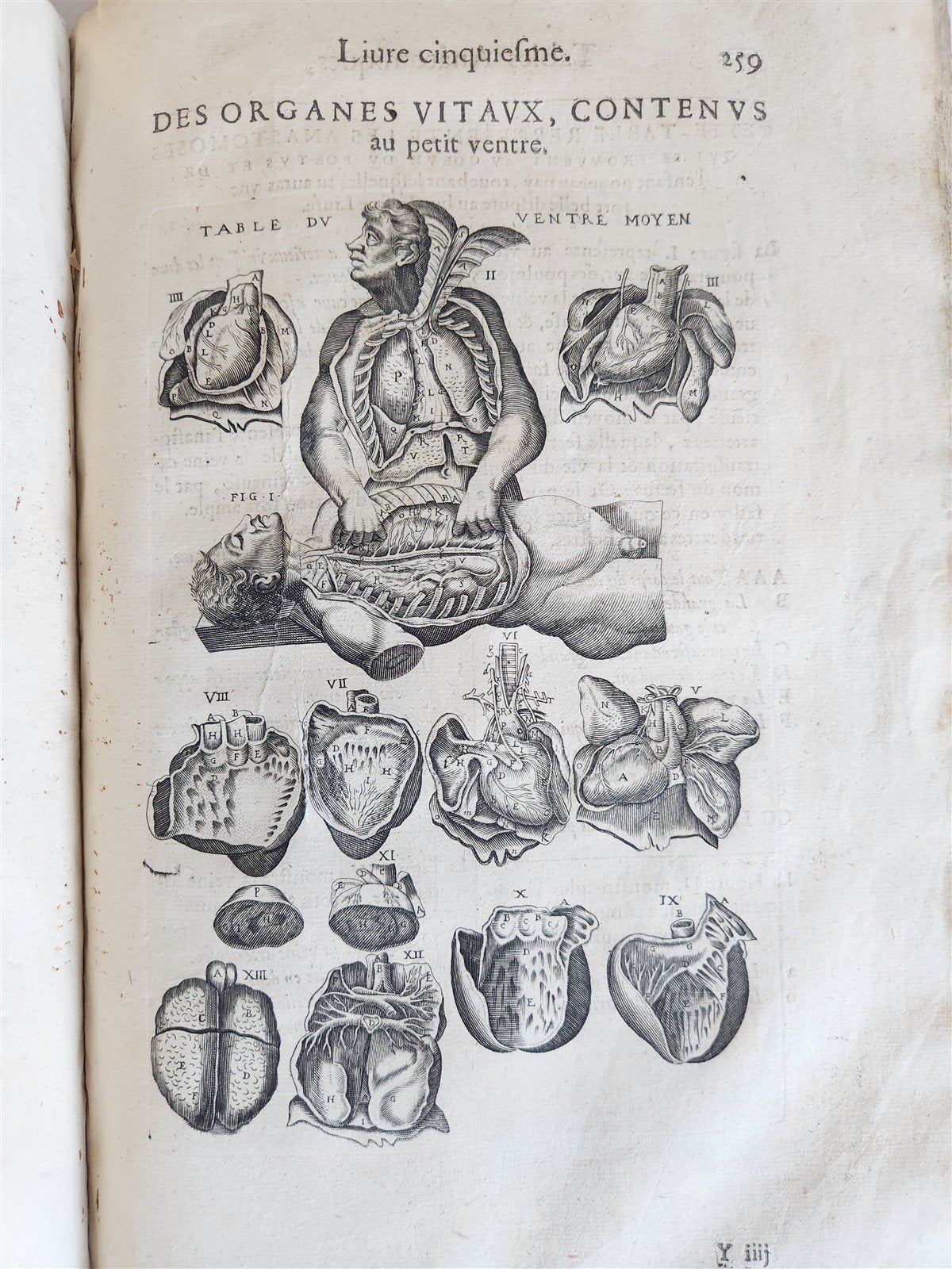 1646 ANATOMY ILLUSTRATED after VESALIUS antique FOLIO 17th CENTURY scarce