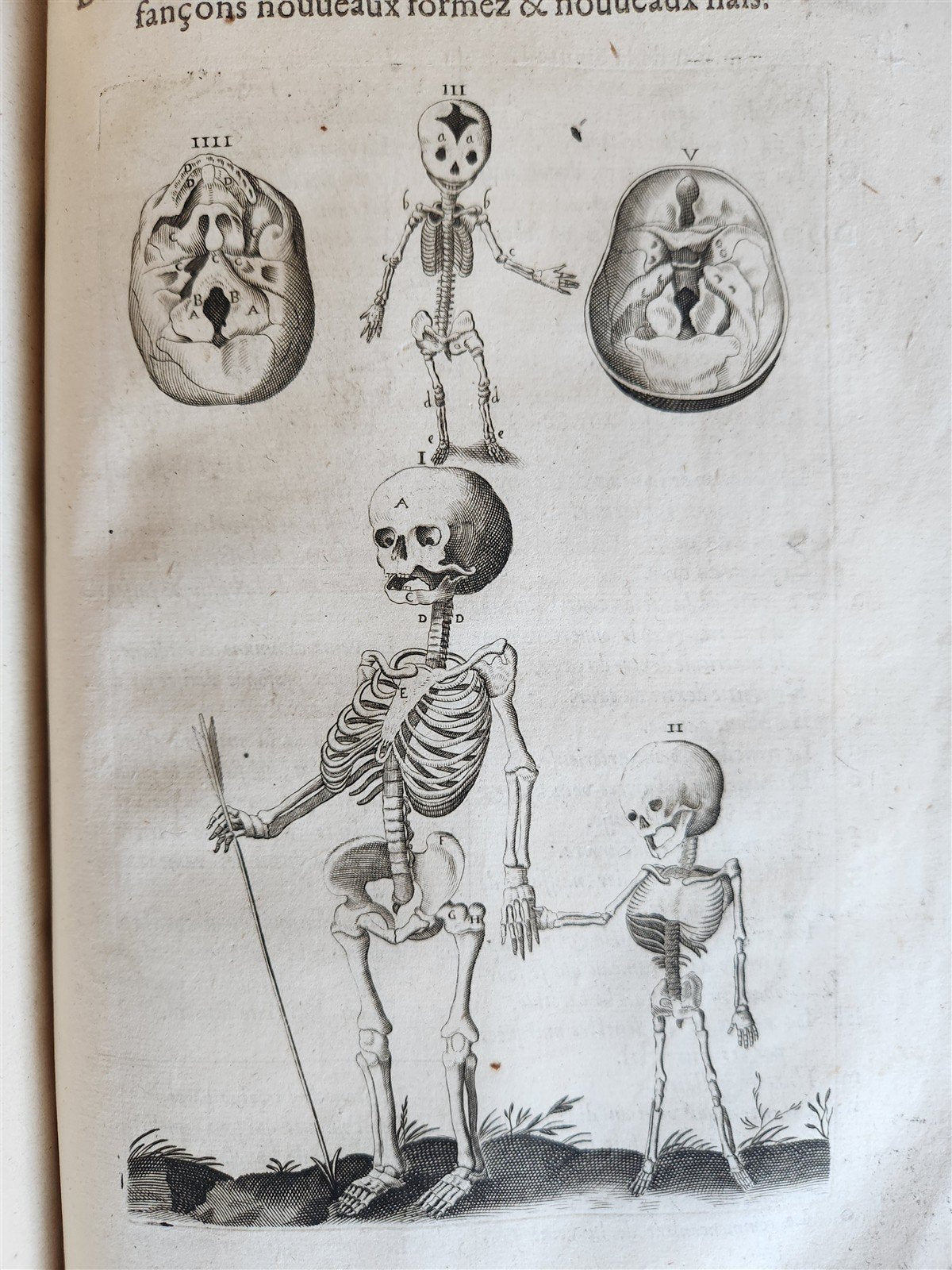 1646 ANATOMY ILLUSTRATED after VESALIUS antique FOLIO 17th CENTURY scarce