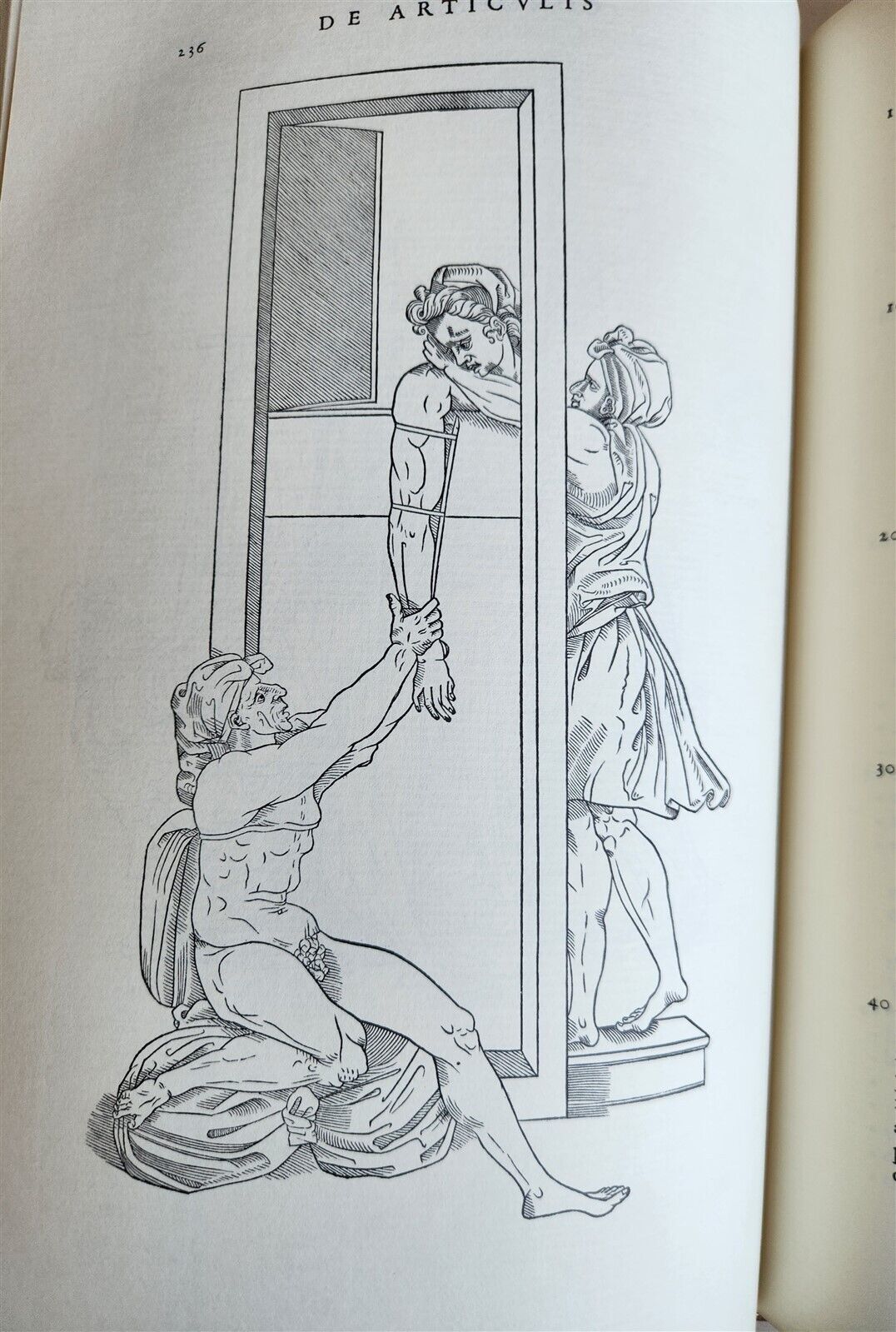 1970 FACSIMILE of Chirurgie a Graeco in Latinum conversa antique ILLUSTRATED