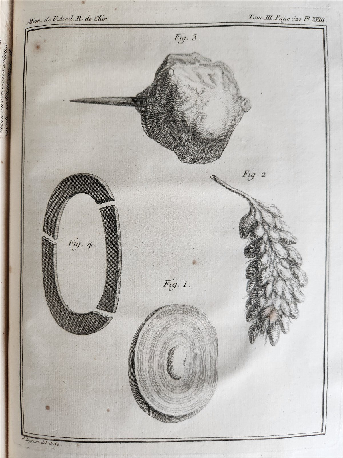 1753 SURGERY ANATOMY ILLUSTRATED antique Memoires l'Academie Royale de Chirurgie
