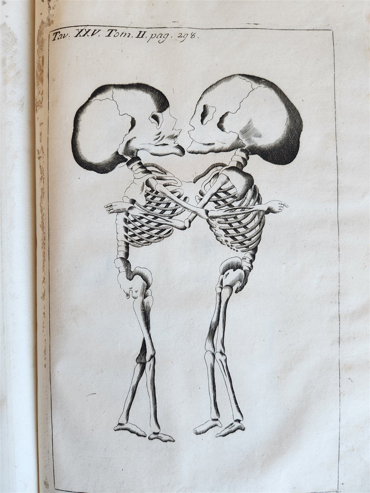 1733 MEDICAL TREATISE by ANTONIO VALLISNERI antique ILLUSTRATED 3 folio volumes