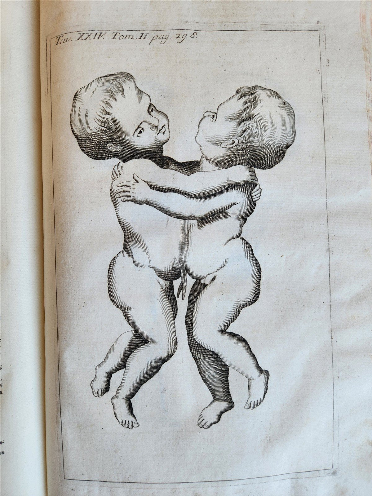1733 MEDICAL TREATISE by ANTONIO VALLISNERI antique ILLUSTRATED 3 folio volumes