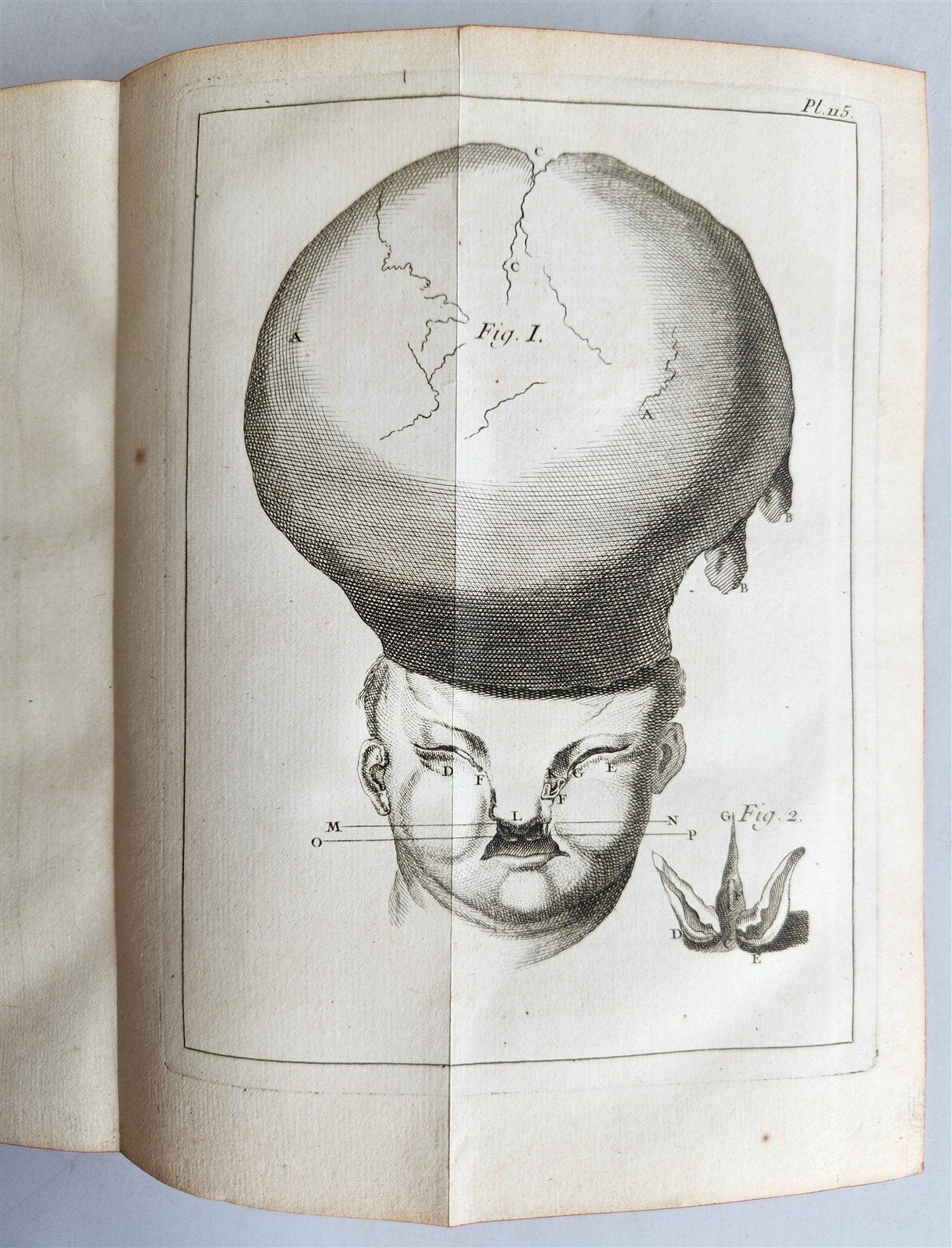 1761 MEDICAL TREATISE ILLUSTRATED ANATOMY by Francois PLANQUE antique V.6