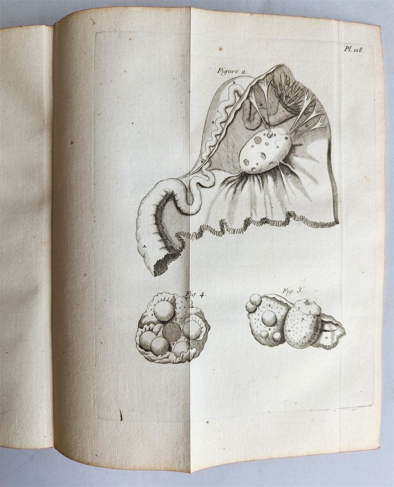 1761 MEDICAL TREATISE ILLUSTRATED ANATOMY by Francois PLANQUE antique V.6