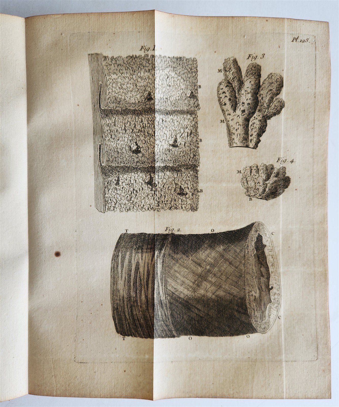 1761 MEDICAL TREATISE ILLUSTRATED ANATOMY by Francois PLANQUE antique V.6