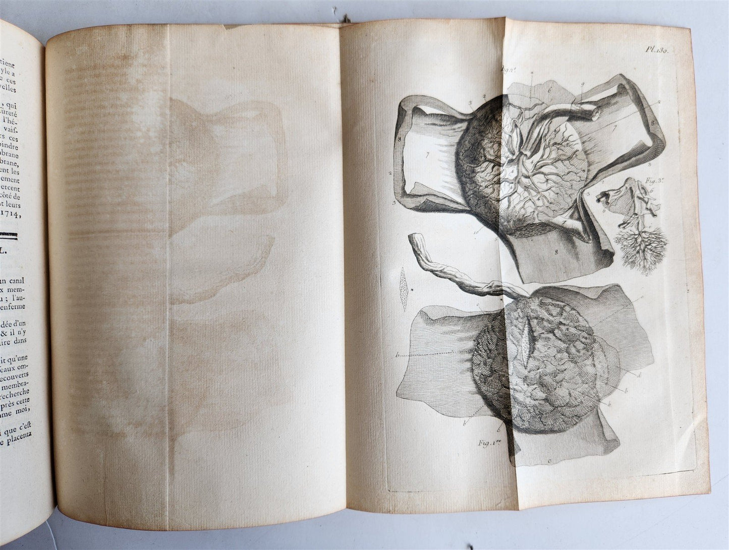 1761 MEDICAL TREATISE ILLUSTRATED ANATOMY by Francois PLANQUE antique V.6