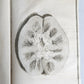 1763 MEDICAL TREATISE ILLUSTRATED ANATOMY by Francois PLANQUE antique V. 8