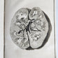 1763 MEDICAL TREATISE ILLUSTRATED ANATOMY by Francois PLANQUE antique V. 8