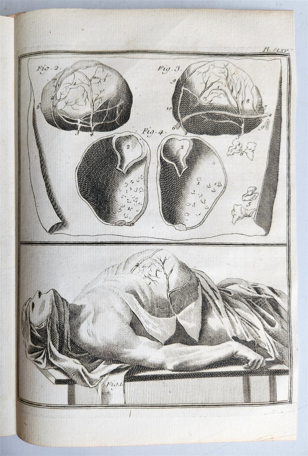 1763 MEDICAL TREATISE ILLUSTRATED ANATOMY by Francois PLANQUE antique V. 8