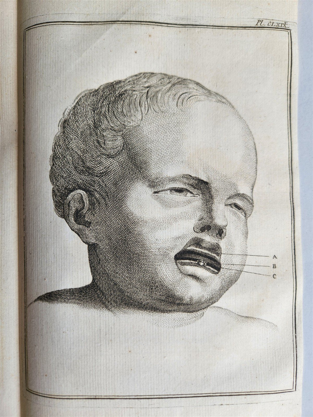 1763 MEDICAL TREATISE ILLUSTRATED ANATOMY by Francois PLANQUE antique V. 8