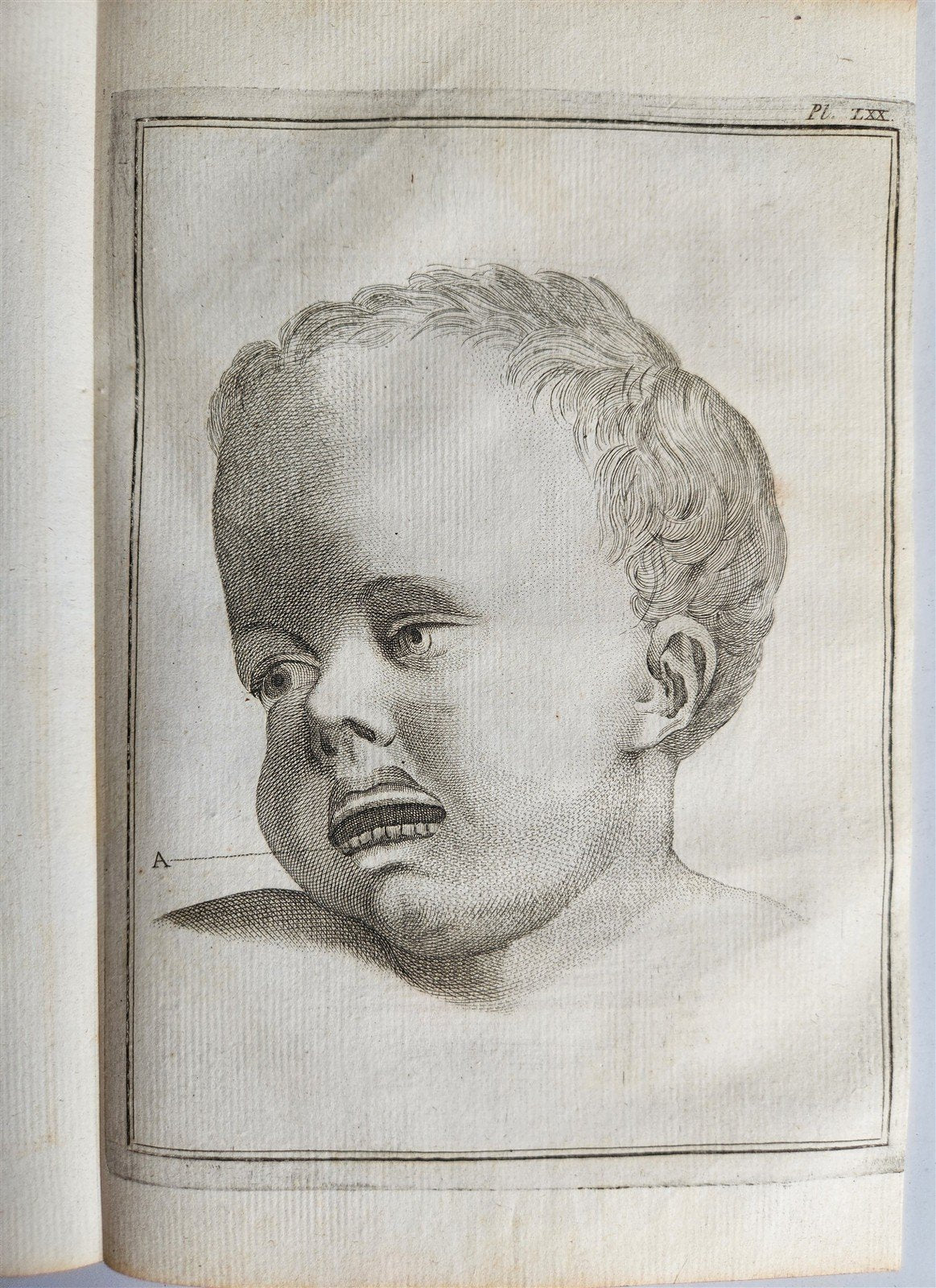 1763 MEDICAL TREATISE ILLUSTRATED ANATOMY by Francois PLANQUE antique V. 8
