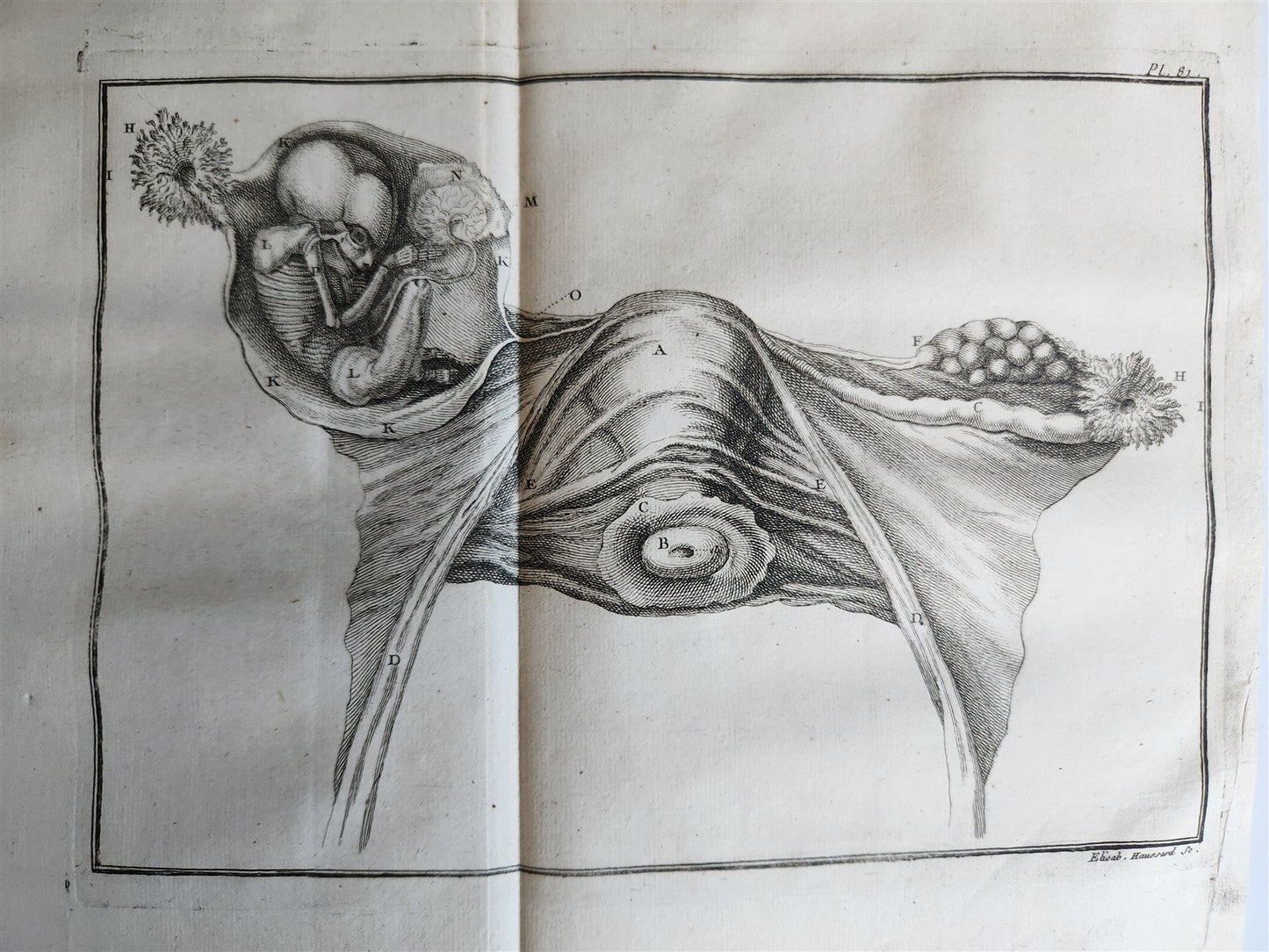 1753 MEDICAL TREATISE ILLUSTRATED ANATOMY by Francois PLANQUE antique V. 4