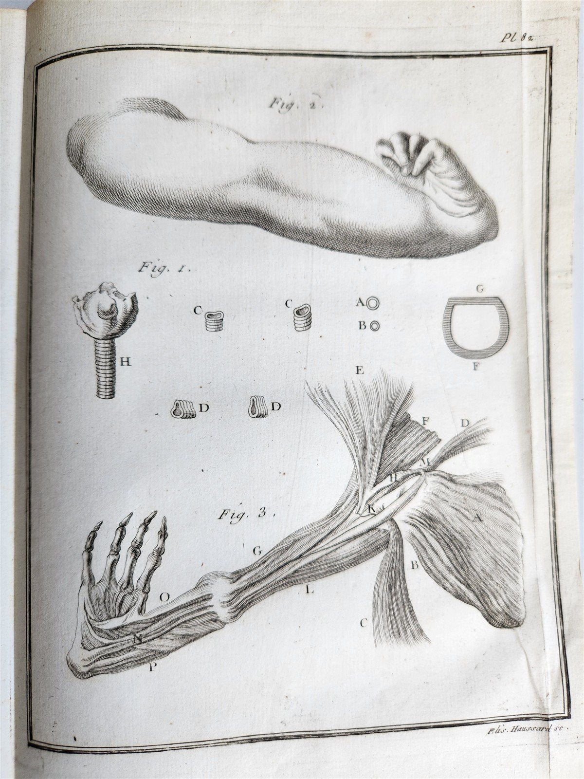 1753 MEDICAL TREATISE ILLUSTRATED ANATOMY by Francois PLANQUE antique V. 4