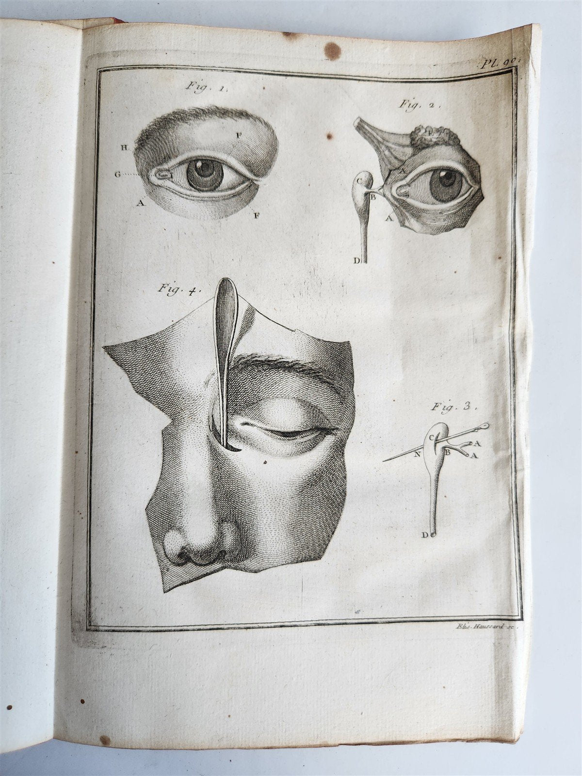 1753 MEDICAL TREATISE ILLUSTRATED ANATOMY by Francois PLANQUE antique V. 4