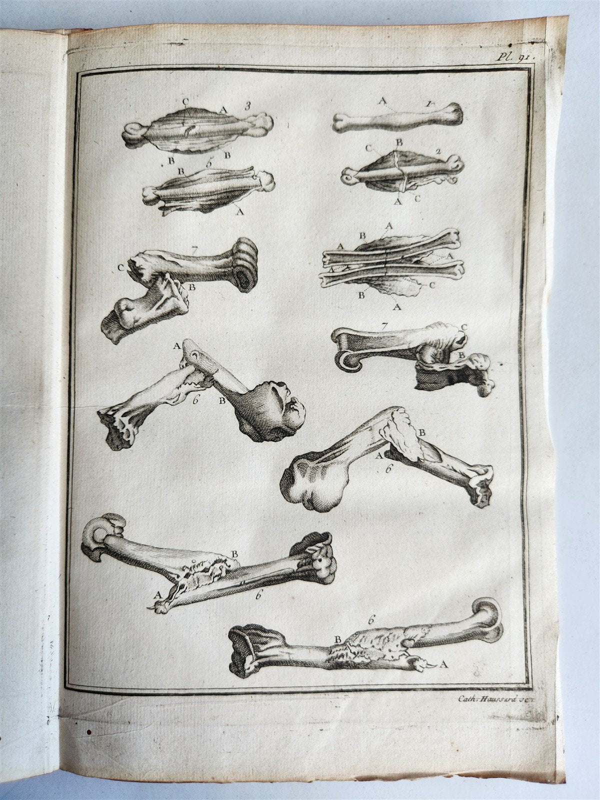 1753 MEDICAL TREATISE ILLUSTRATED ANATOMY by Francois PLANQUE antique V. 4