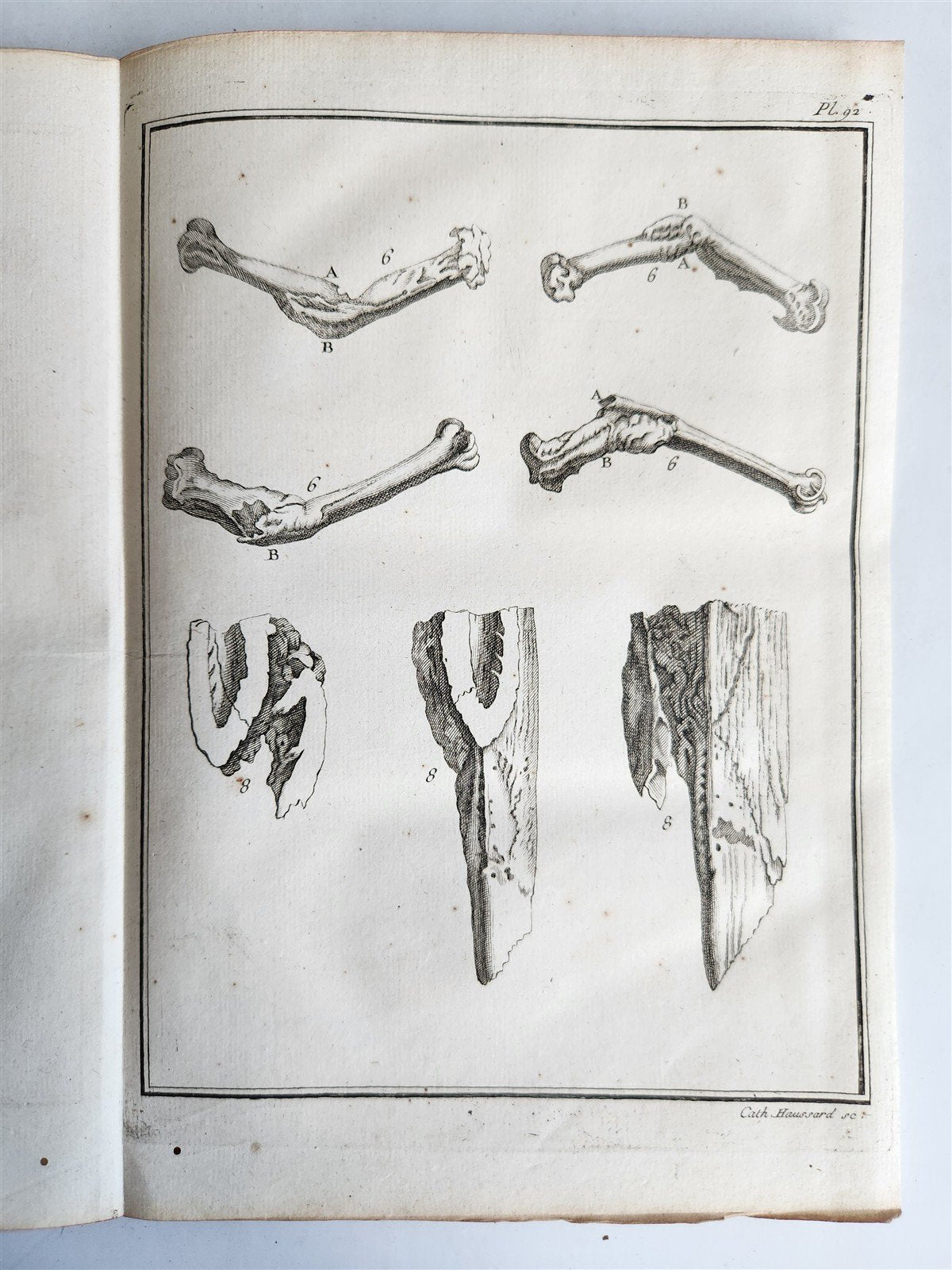1753 MEDICAL TREATISE ILLUSTRATED ANATOMY by Francois PLANQUE antique V. 4
