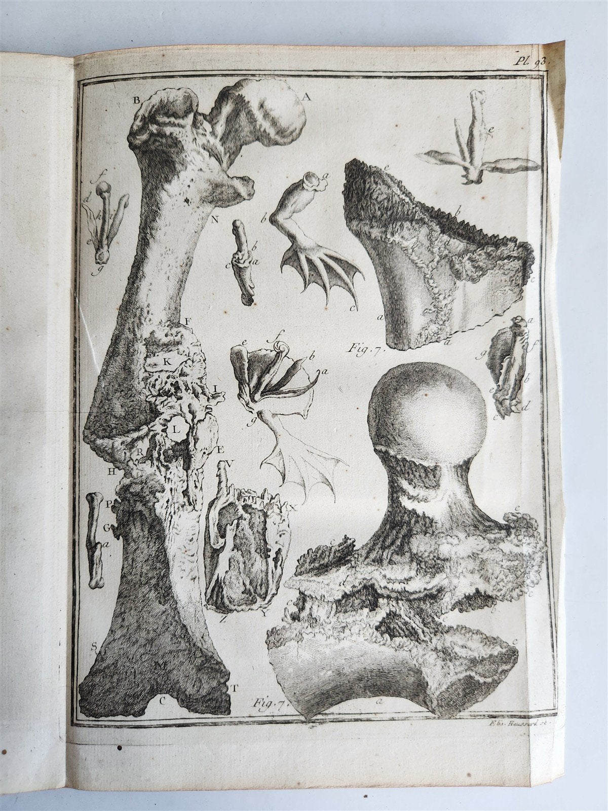 1753 MEDICAL TREATISE ILLUSTRATED ANATOMY by Francois PLANQUE antique V. 4