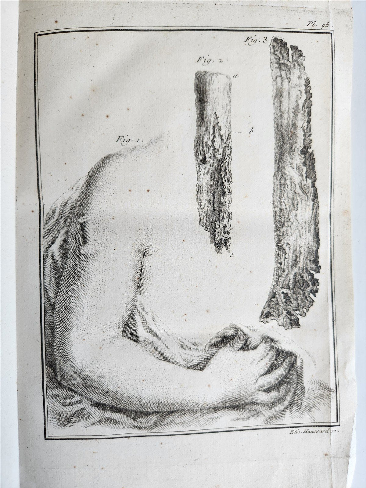 1753 MEDICAL TREATISE ILLUSTRATED ANATOMY by Francois PLANQUE antique V. 4