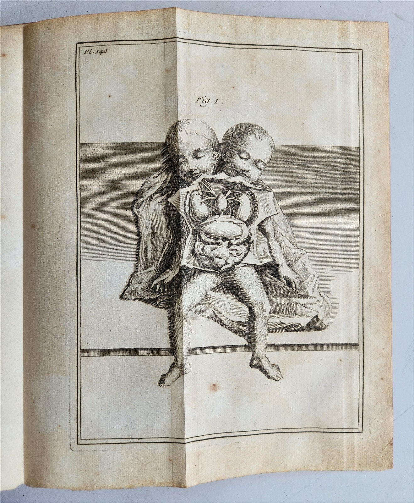 1752 MEDICAL TREATISE ILLUSTRATED ANATOMY by Francois PLANQUE antique V. 7