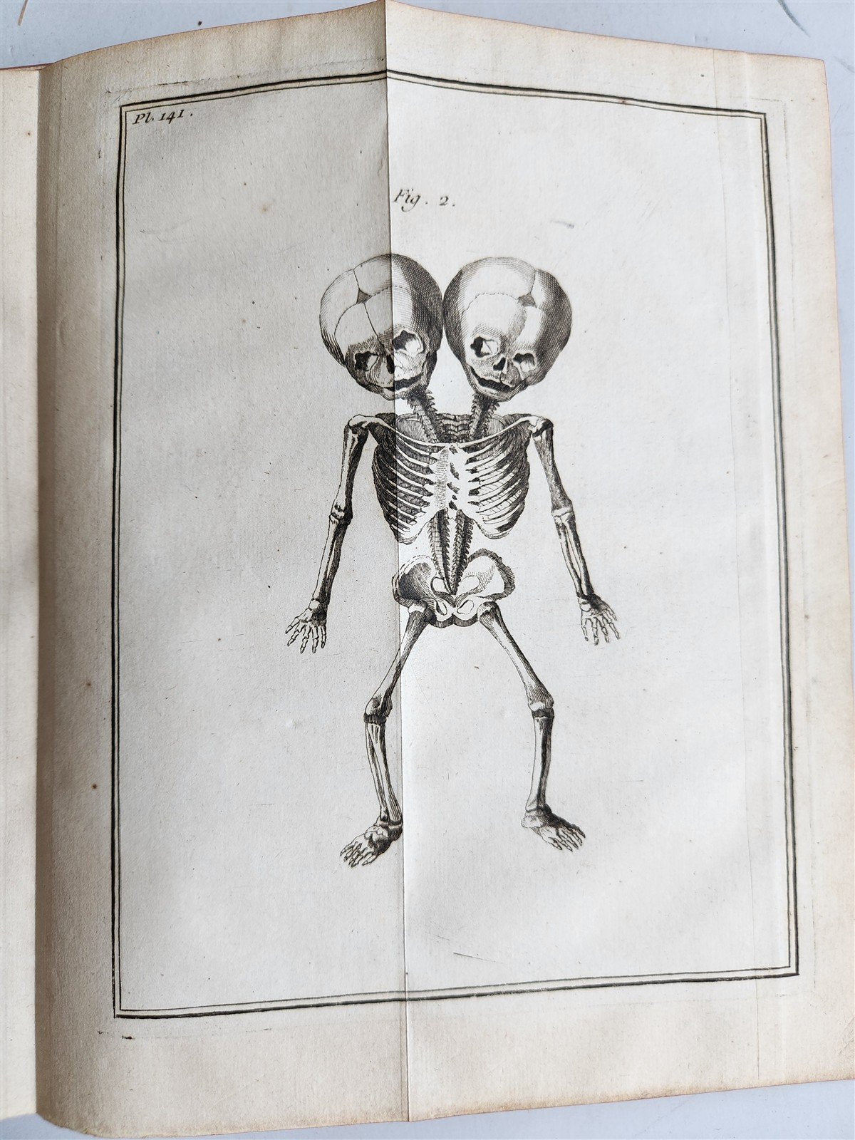 1752 MEDICAL TREATISE ILLUSTRATED ANATOMY by Francois PLANQUE antique V. 7