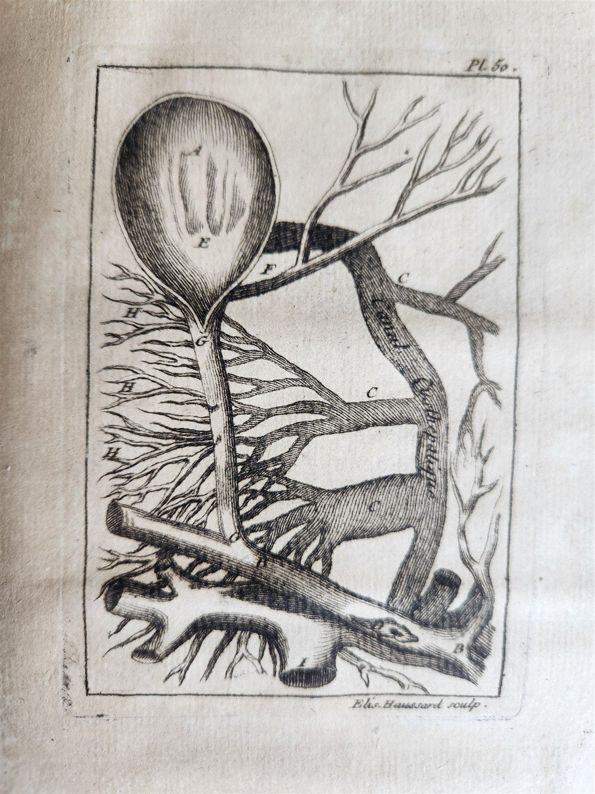 1750 MEDICAL TREATISE ILLUSTRATED ANATOMY by Francois PLANQUE antique V. 3