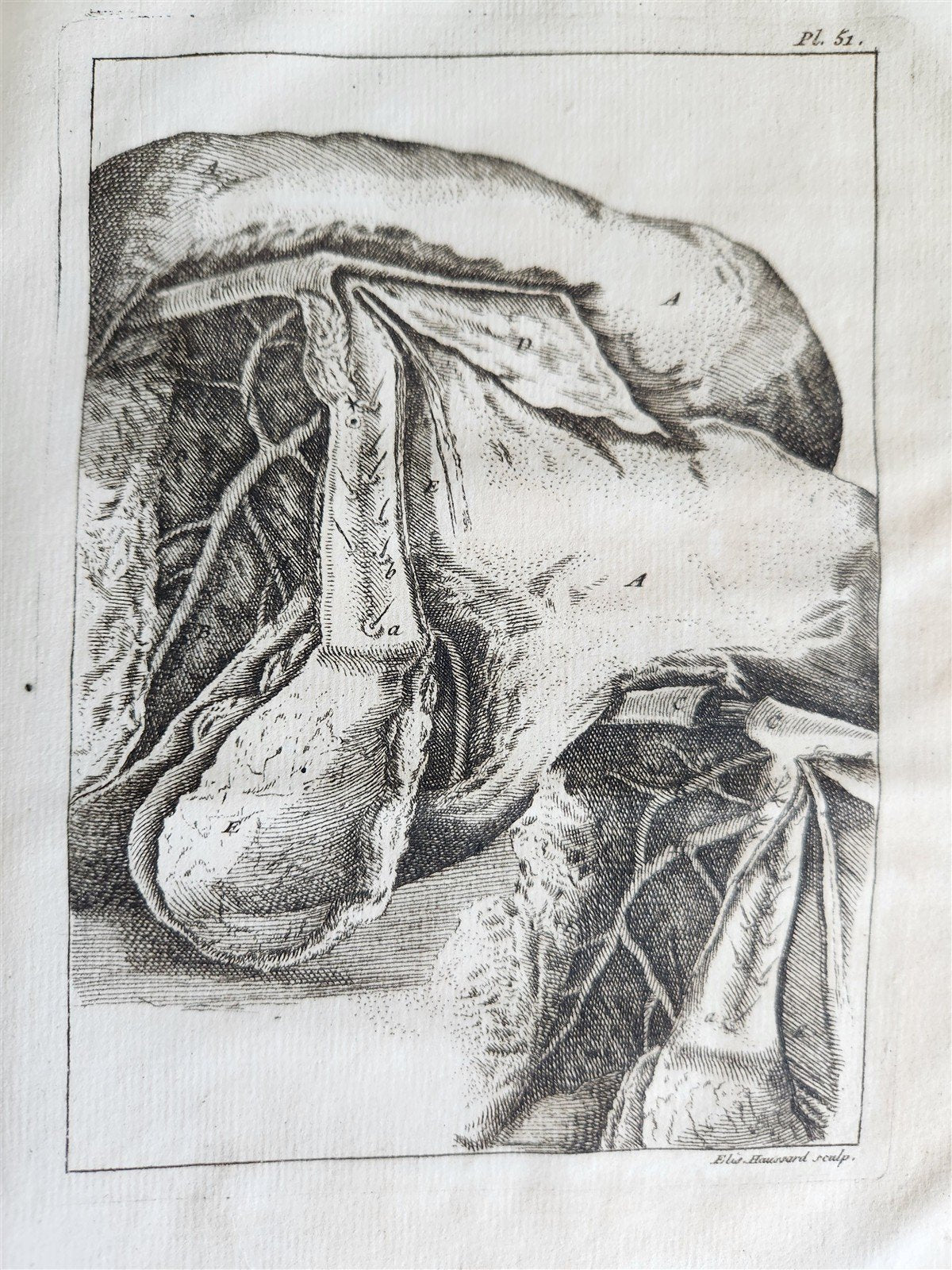 1750 MEDICAL TREATISE ILLUSTRATED ANATOMY by Francois PLANQUE antique V. 3